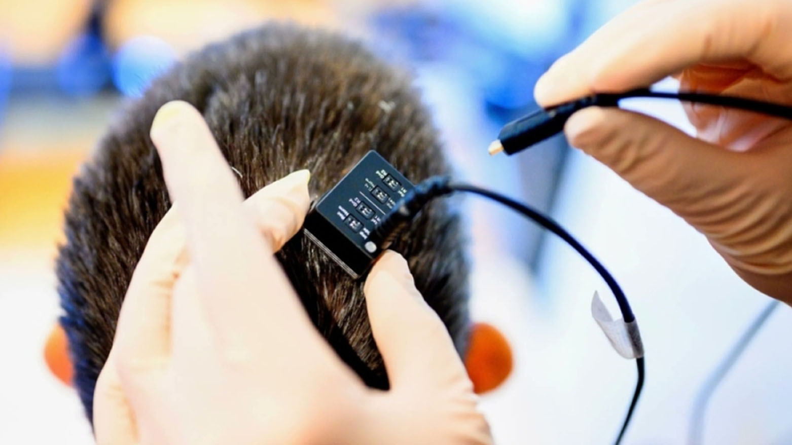 غرسة دماغية تترجم الأفكار إلى كلام مسموع بشكل فوري