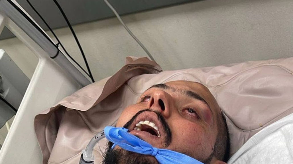 بغداد.. تعذيب مهندس على يد الشرطة الاتحادية يثير موجة استنكار