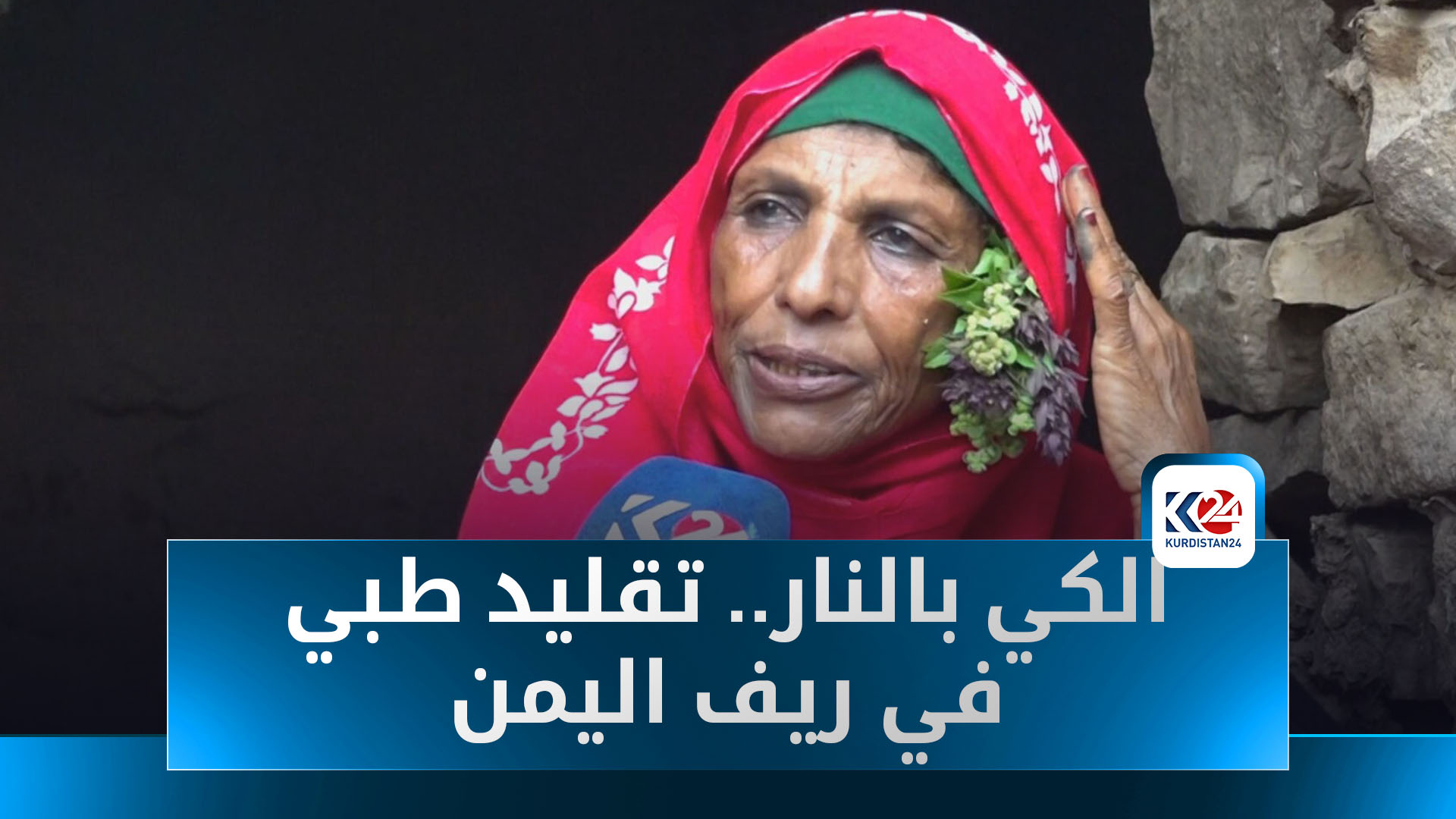 الكي بالنار.. تقليد طبي متجذر في ريف اليمن رغم تطور الطب الحديث