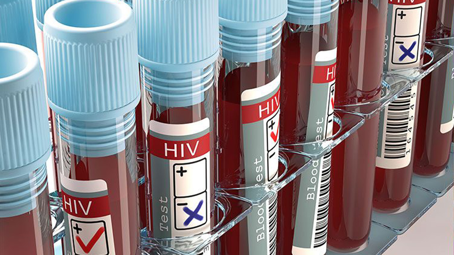 HIV tedavisinde büyük adım: Hücre içinde görünür hale getirildi