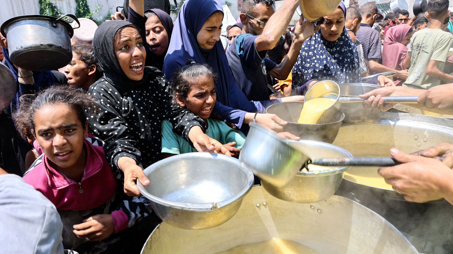 بينهم 93 طفلا.. صحة غزة تعلن ارتفاع حصيلة ضحايا الجوع إلى 180
