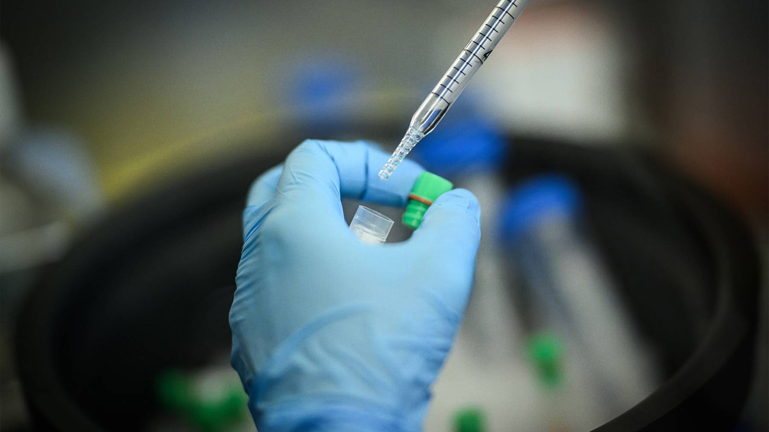 The photo shows a researcher working on a lung cancer vaccine. (AFP)