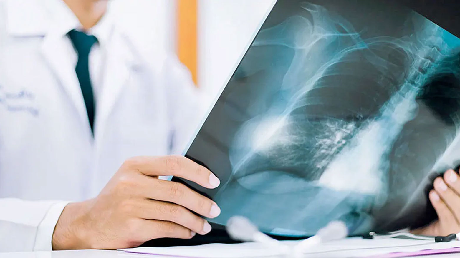 علماء يطوّرون كبسولة للكشف المبكر عن سرطان المريء