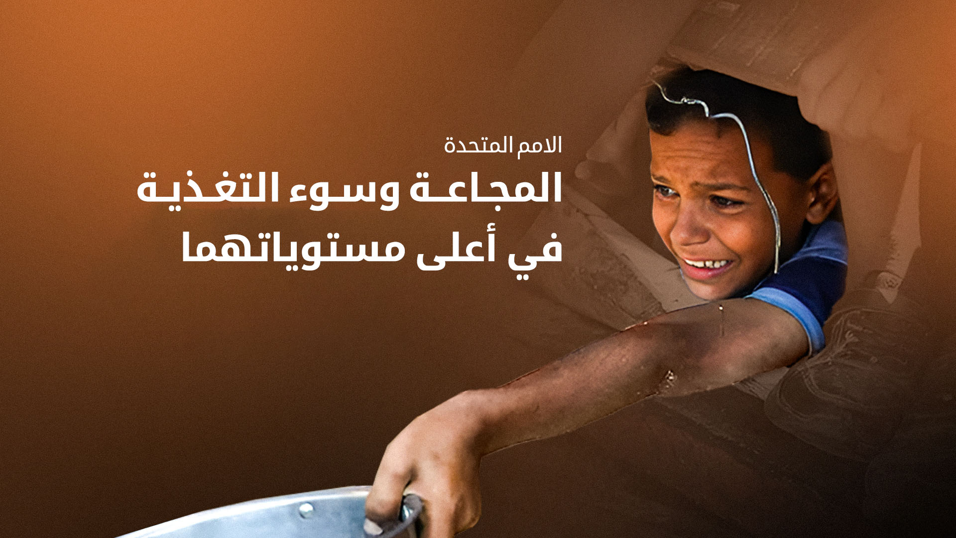 الأمم المتحدة: وفاة أكثر من 100 طفل في غزة بسبب سوء التغذية