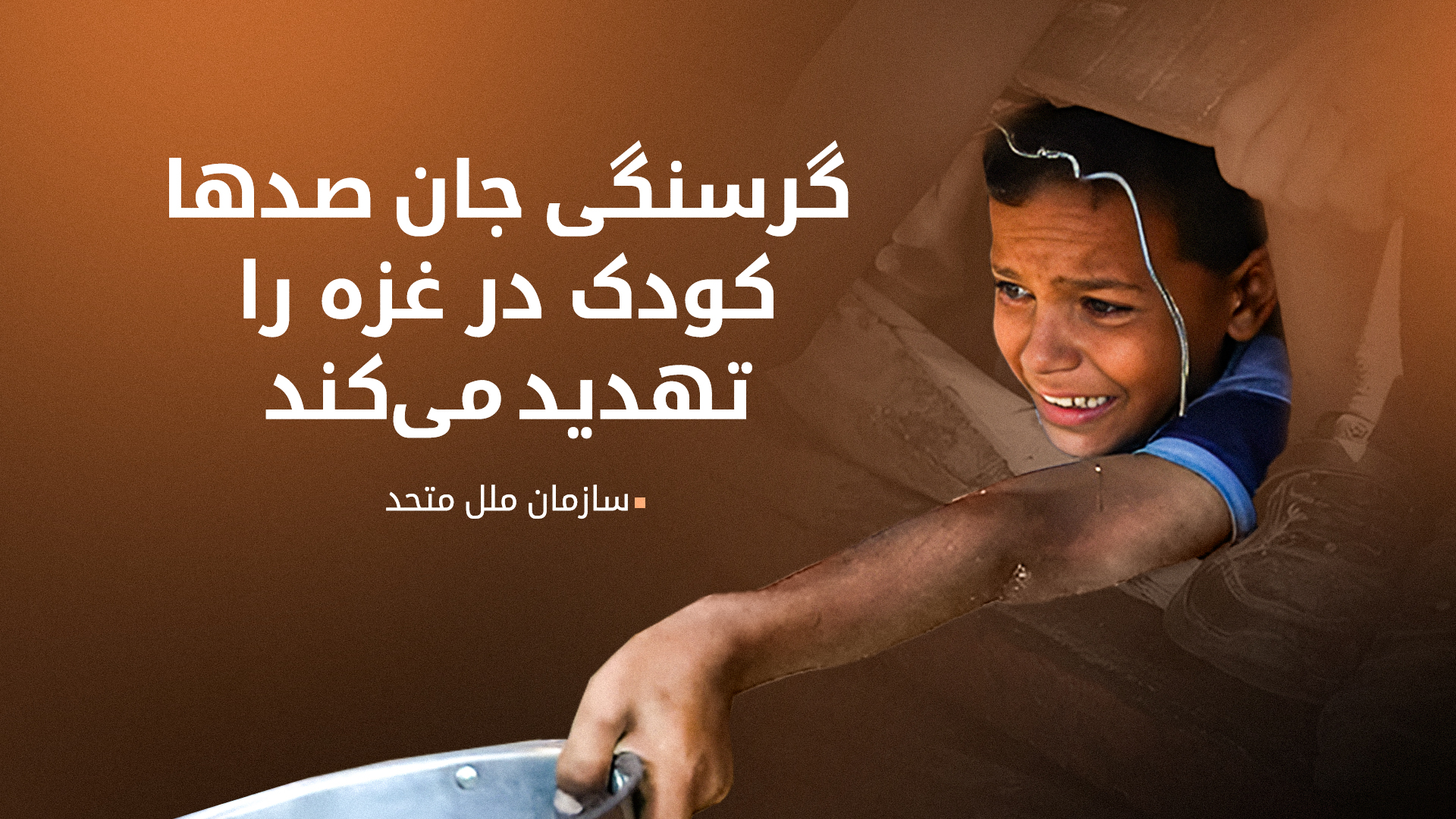 مرگ ۱۰۰ کودک بر اثر گرسنگی؛ جان ۳۰۰ کودک دیگر در خطر است