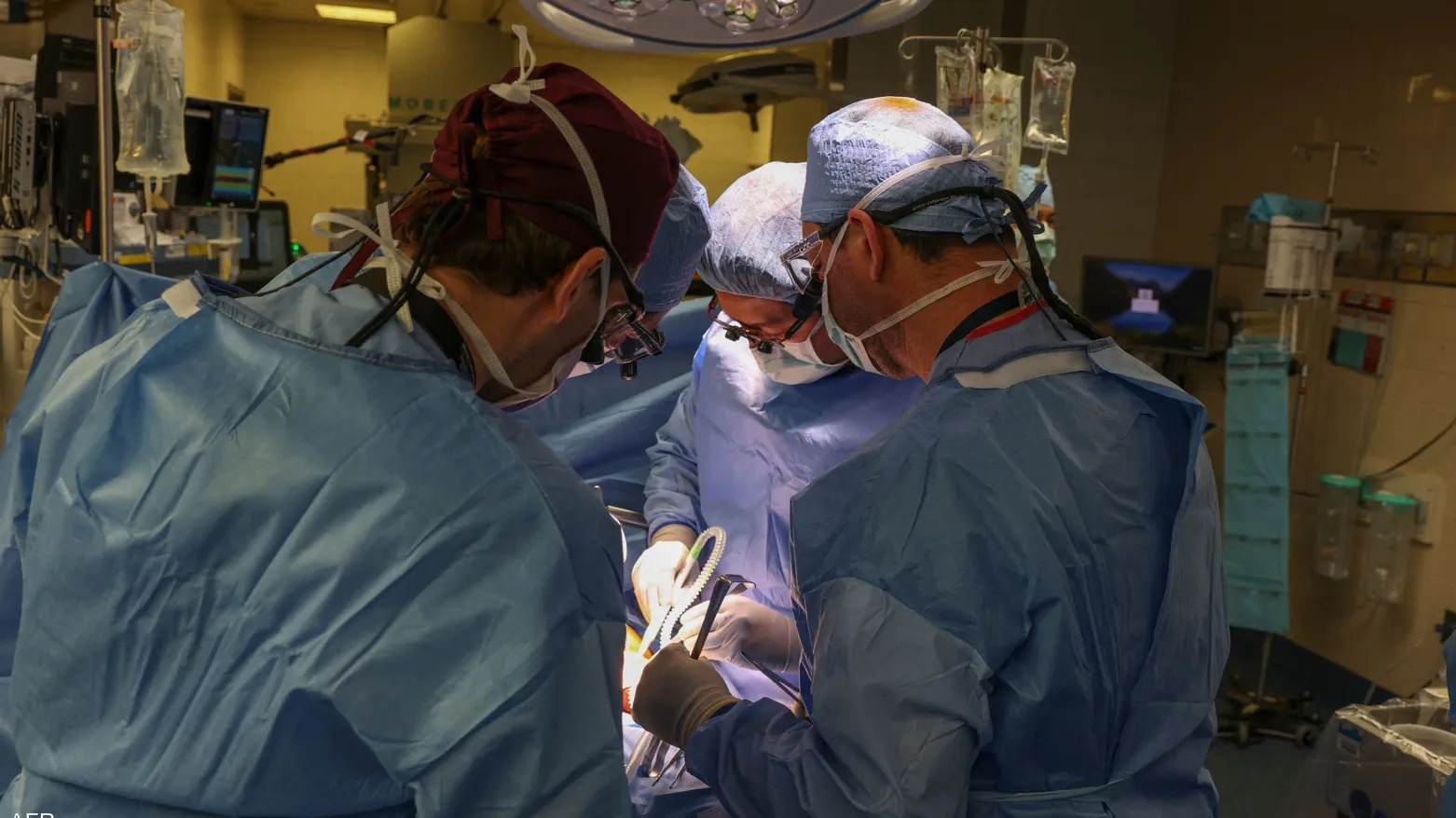 علماء ينجحون في زرع رئة خنزير بجسم إنسان لأول مرة