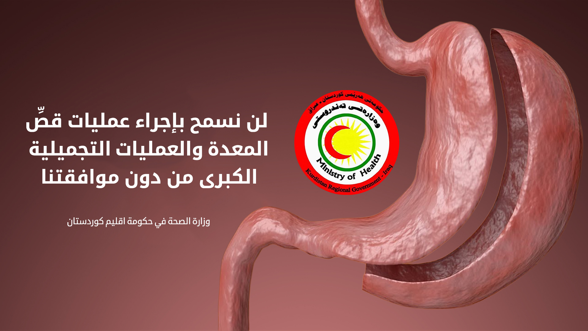 صحة كوردستان تسمح بإجراء عمليات قصِّ المعدة.. لكن بشروط!