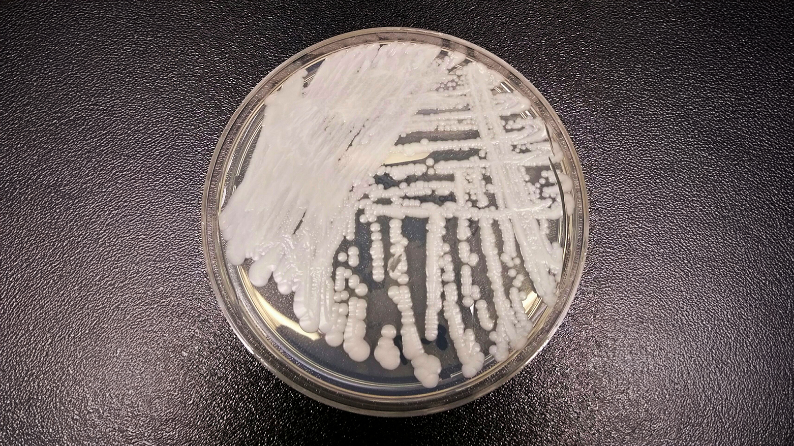 CDC image shows Candida auris; U.S. cases tripled over three years. (AP)