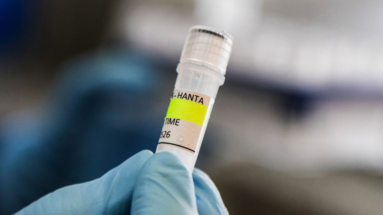 Malbrán scientist holds Andes hantavirus sample in Buenos Aires, May 6, 2026. (Photo: AP)