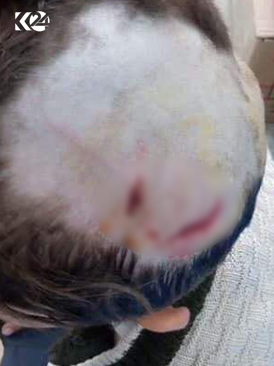 675