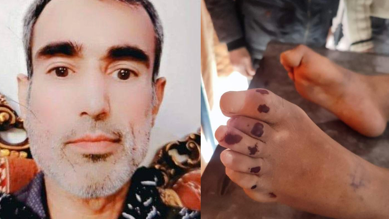 Luqman Hamid Hanan reportedly died from torture at the hands of a Turkish-backed faction (Photo: Afrin Media Centre).