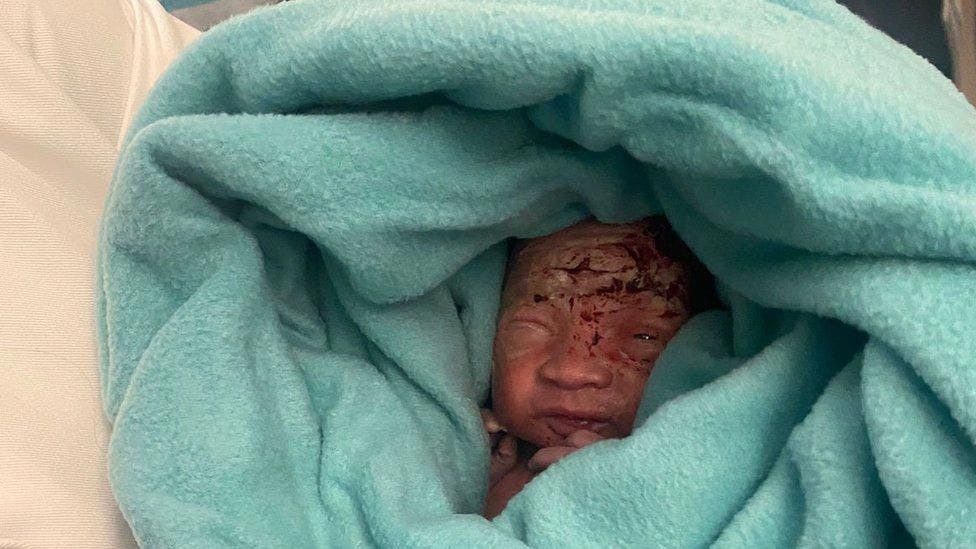 دایكه‌كه‌ بێباكانه‌ منداڵه‌ تازه‌ له‌دایكبووه‌كه‌ی له‌ناو سه‌به‌تی زبڵی توالێت فڕێداوه‌