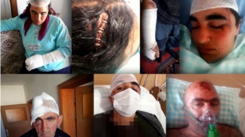 Members of the Kurdish Dedeoglu family were injured in an attack in Konya, central Turkey, on May 12, 2021. The family were killed on July 30, 2021. (Photo: Yeni Yasam/BIA net)
