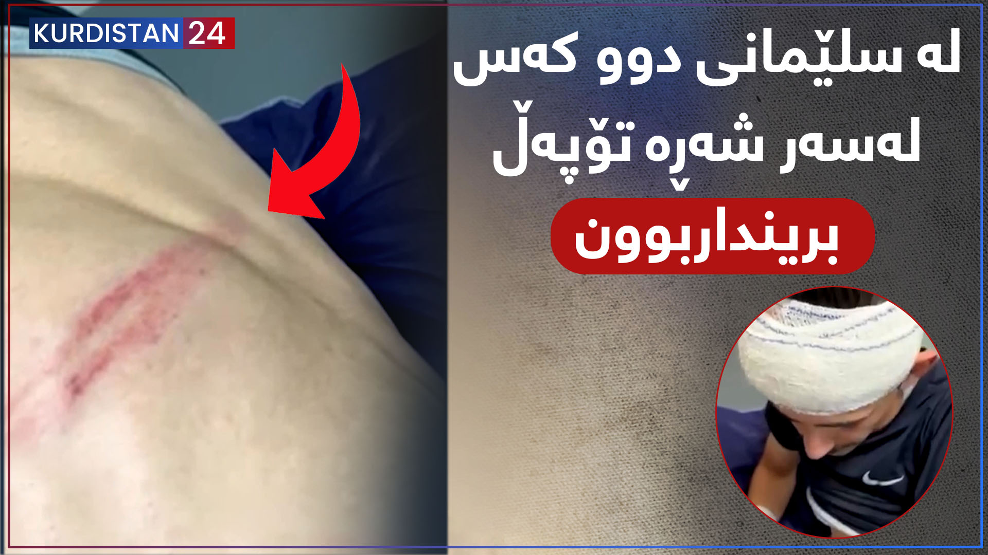 چیرۆکە هەواڵ | لە سلێمانی دوو کەس لەسەر شەڕە تۆپەڵ برینداربوون