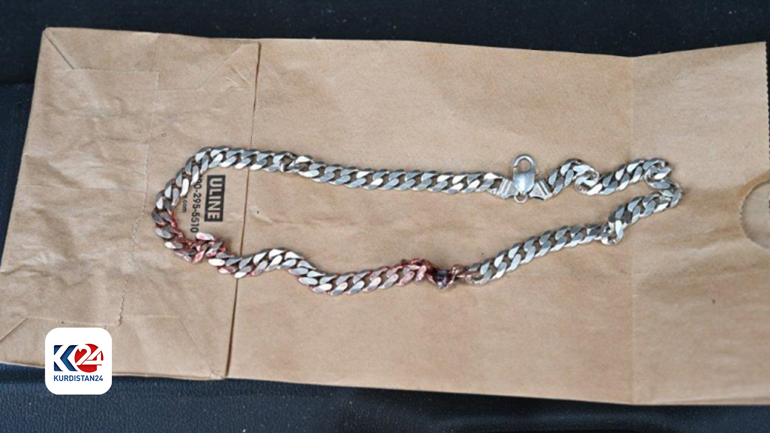 Boynundaki zincir sayesinde ölümden döndü