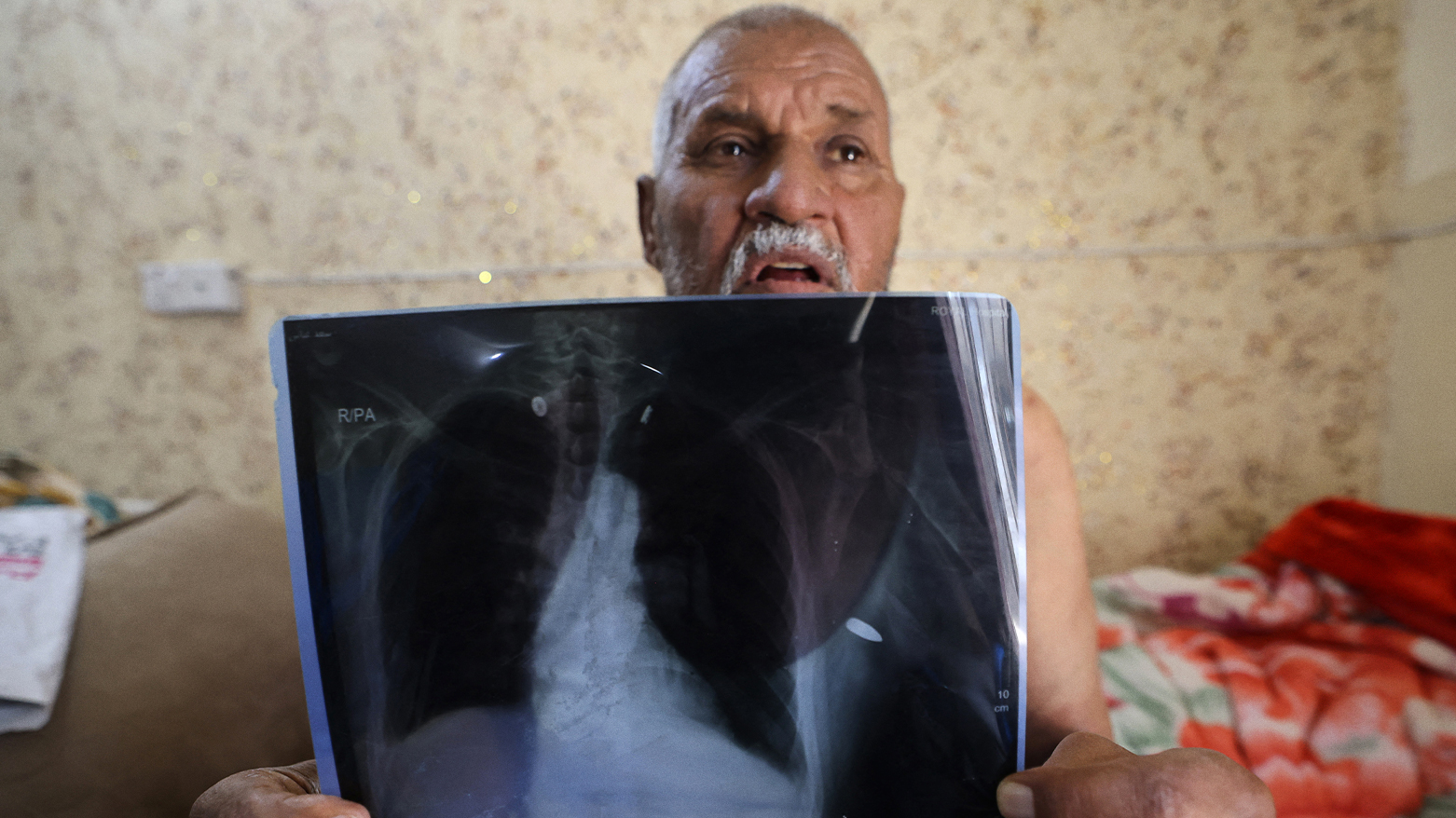 Saad Abbas, 59-years-old, who was injured by a random gunshot in his home in a village in the Yusufiya area near Baghdad on May 20, 2024, holds an x-ray of his injury as he sits in his home during a government campaign to register the weapons in possession of citizens. (Photo: AFP)