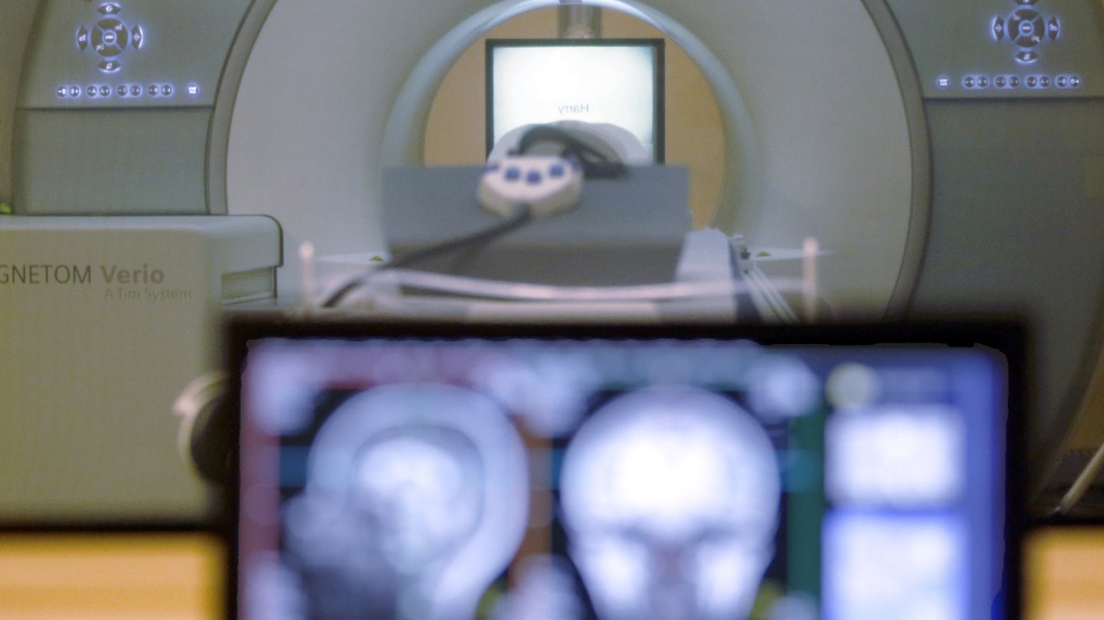 A view of the Magnetic Resonance Imaging (MRI) machine. (Photo: AP)