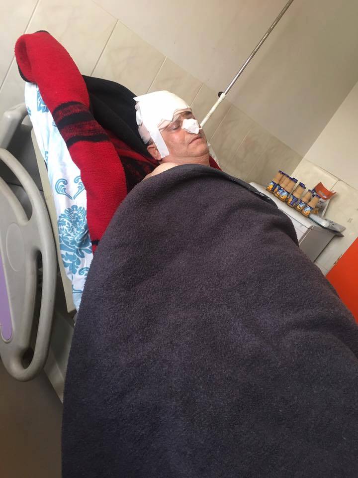 PHOTO: Kurdish man dies due to torture in Rojava prison 