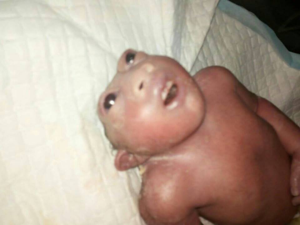 منداڵێكی بێ سەر لە دایك بوو