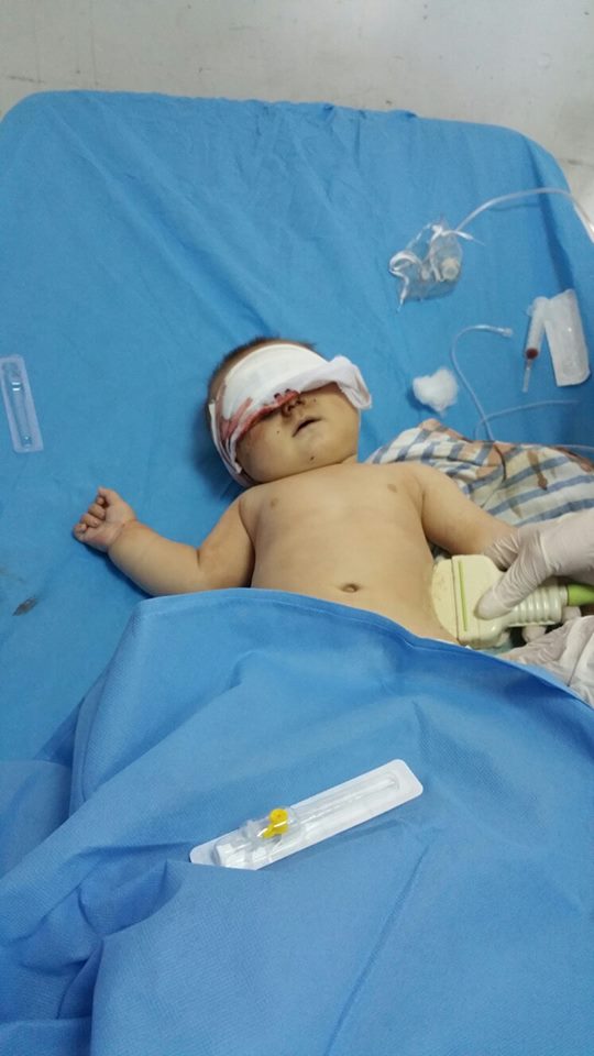 یەكێك لە بریندارانی تەقینەوەی حەسەكە لە دھۆك گیانی لە دەستدا