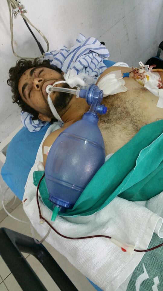 یەكێك لە بریندارانی تەقینەوەی حەسەكە لە دھۆك گیانی لە دەستدا