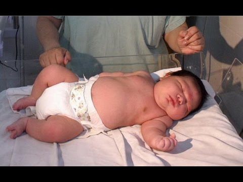 به‌وێنه‌یه‌.. ئه‌م كۆرپه‌له‌ تازه‌ له‌دایكبووه‌ و كێشه‌كه‌ی 7 كیلۆگرامه‌