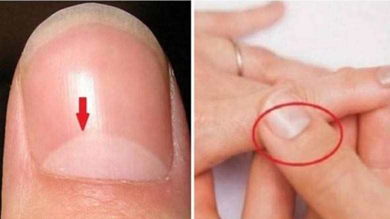 چه‌ند نهێنييه‌ك له‌باره‌ى نيمچه‌ بازنه‌ى سه‌ر نينۆكه‌كان