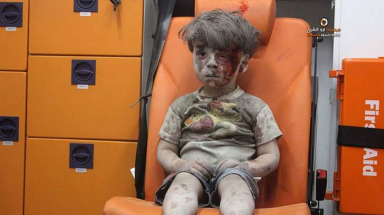 "طفل حلب" الذي صدم العالم بصوره.. يفقد شقيقه الاكبر