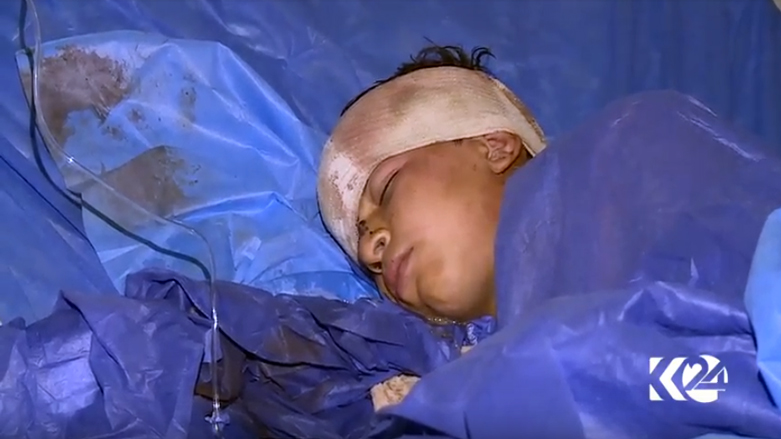 بەركەوتووانی كیمیایی داعش لە نەخۆشخانەكانی ھەولێر چارەسەر دەكرێن