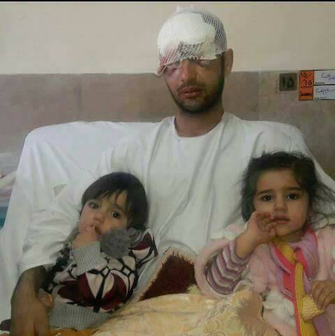 Kurdish Kulbar, father of two, lost his sight reportedly from the direct shooting of Iranian border guards.