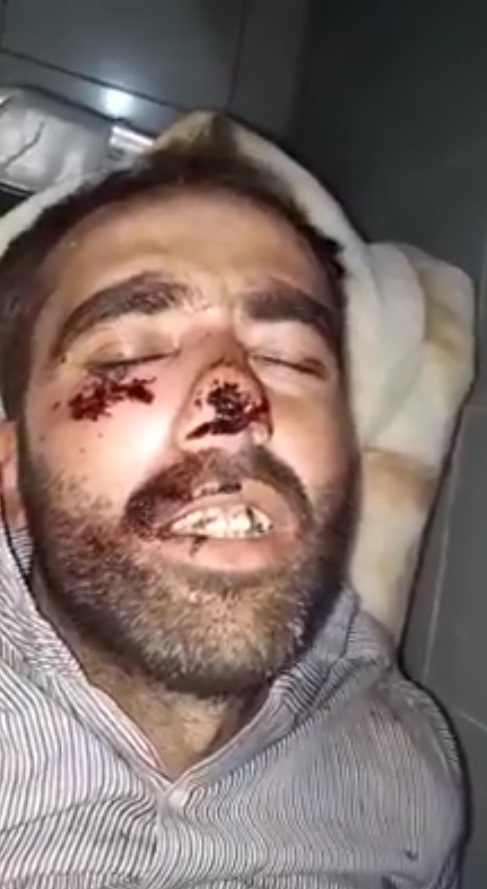 Artêşa Tirkiyê devera Şehba dide ber topan: 4 kuştî hene