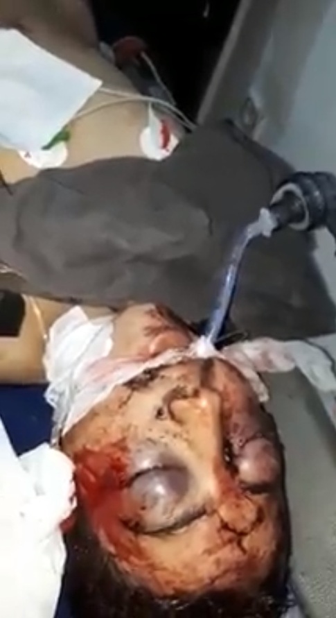 Artêşa Tirkiyê devera Şehba dide ber topan: 4 kuştî hene