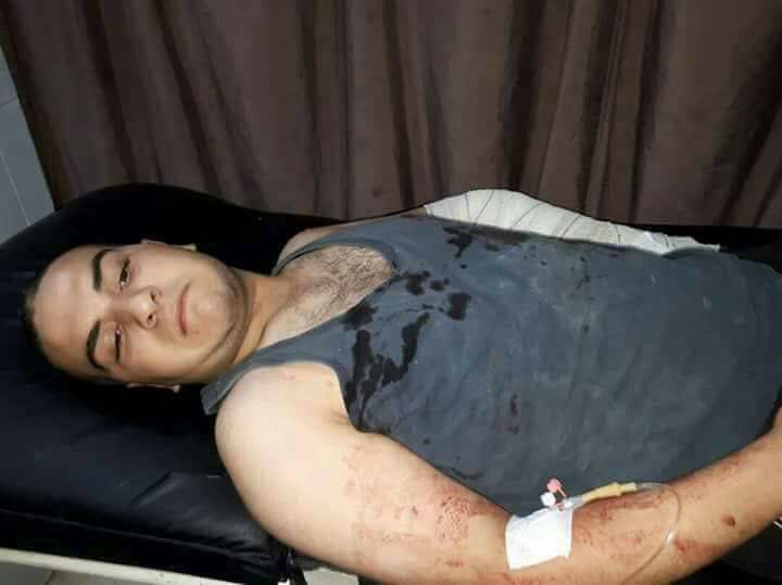 Artêşa Tirkiyê Efrînê dide ber topan: 7 birîndar