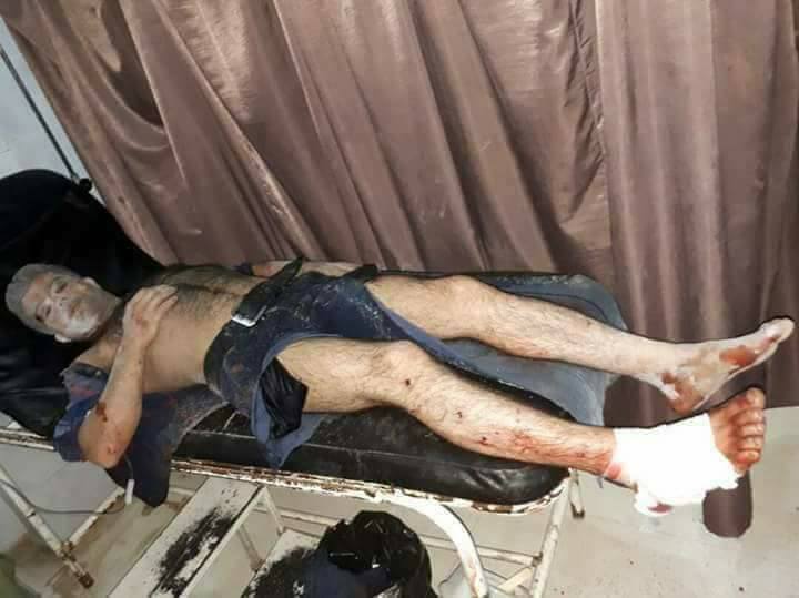 Artêşa Tirkiyê Efrînê dide ber topan: 7 birîndar