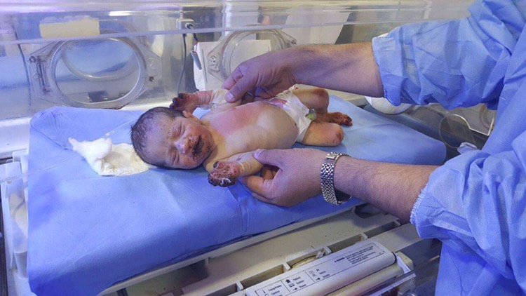 بە وێنە... منداڵێك بە برینداری دۆزرایەوە