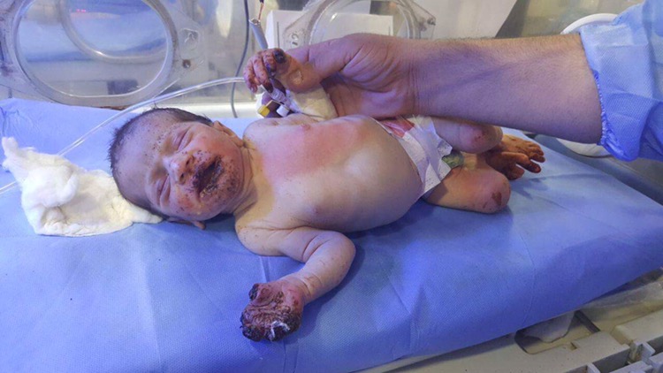 بە وێنە... منداڵێك بە برینداری دۆزرایەوە