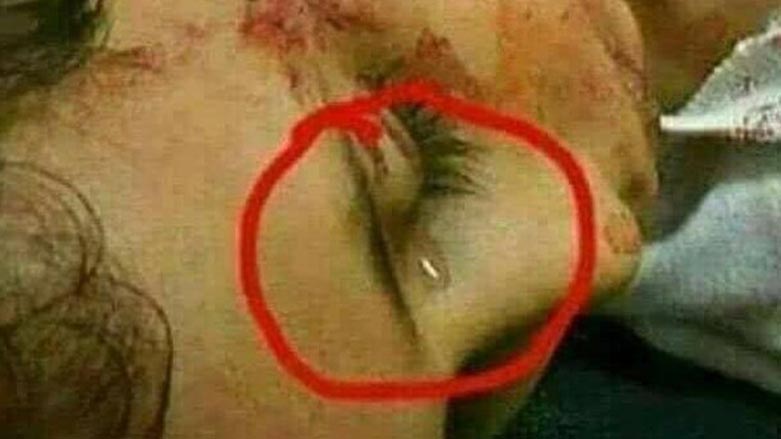 منداڵێك به‌ چاوی به‌ فرمێسكه‌وه‌ گیانی له‌ده‌ستداوه‌