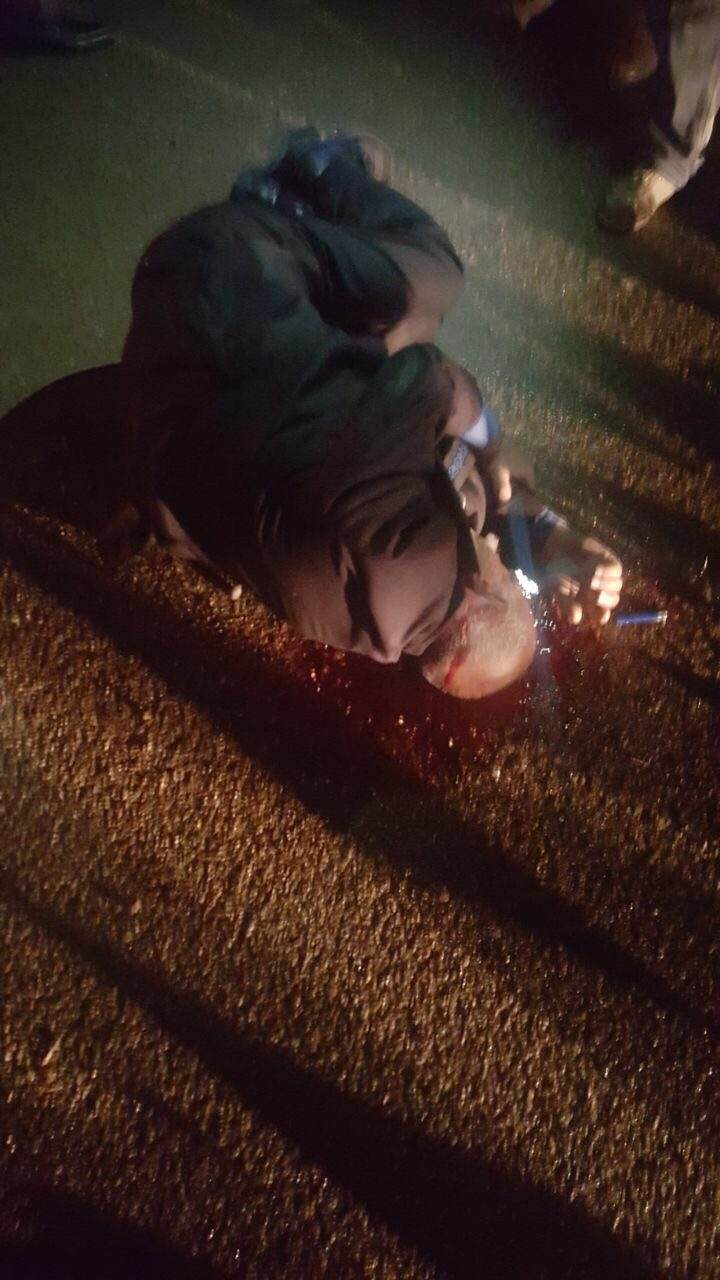 ته‌رمى عه‌لائه‌دين مه‌قسود زينه‌ڵ، به‌رپرسى باره‌گاى جه‌بهه‌ى توركمانى له‌ گه‌ڕه‌كى عه‌سكه‌رى شارى كه‌ركووك، فۆتۆ: فه‌يسبووك