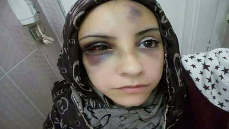 وێنه‌ی ئه‌و ئافره‌ته‌ ببینه‌ كه‌ به‌توندی له‌لایه‌ن سه‌ركرده‌یه‌كی ره‌وتی حیكمه‌وه‌ ئه‌شكه‌نجه‌ دراوه