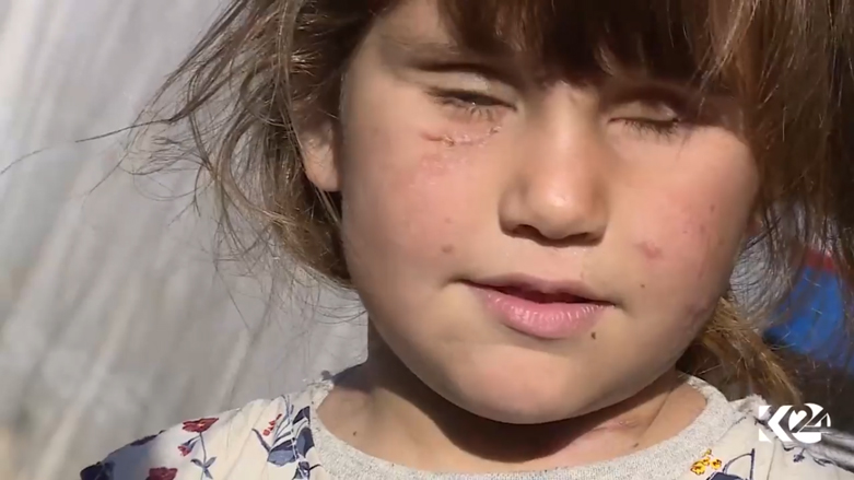 جد الطفلة دعاء: لا املك ثمن حذاء لها فكيف أعالج عينيها