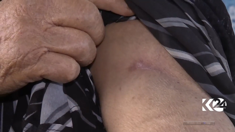 اصيبت مريم بطلق ناري في كتفها من قبل داعش