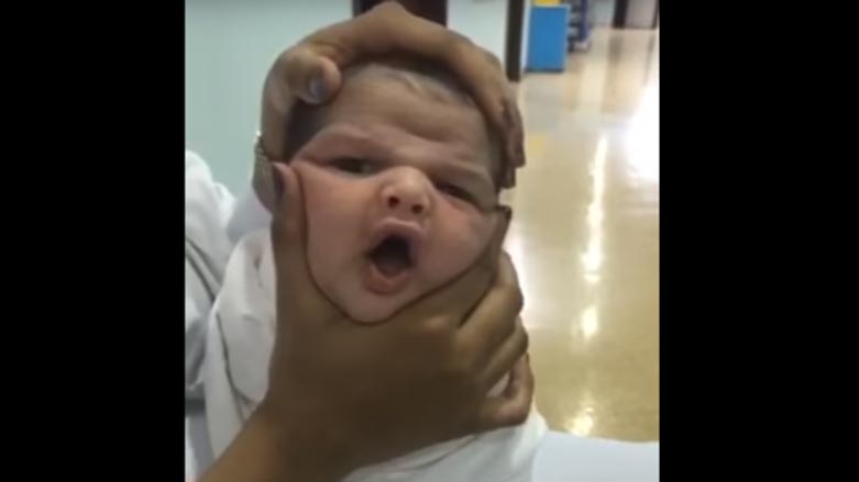 به‌ ڤيديۆ.. له‌ نه‌خۆشخانه‌ى له‌دايكبوون يارى به‌ كۆرپه‌له‌يه‌ك ده‌كرێت