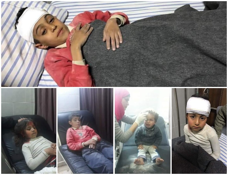 Zarokên Efrînê yên ji encama topbaran artêşa Tirkiyê birîndar bûne / 21.02.2018