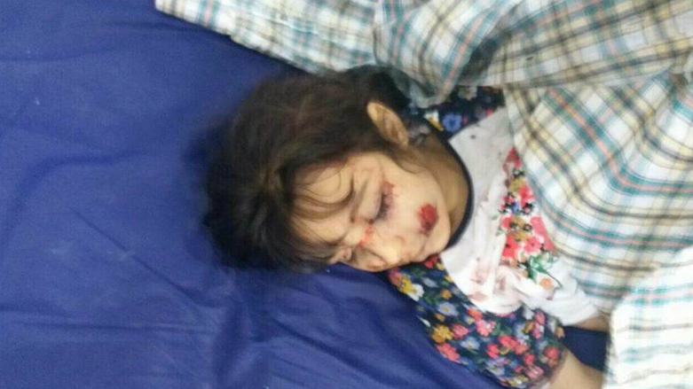 A photo circulated by activists on social media shows one of the victims of the IS ambush. (Photo: Facebook)