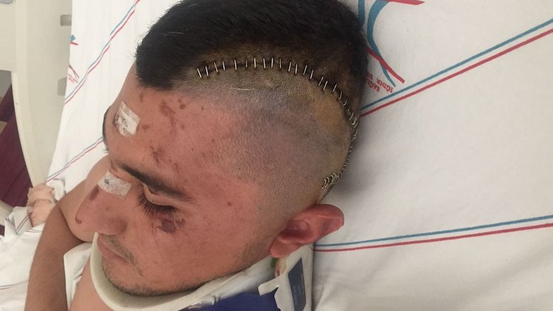 Conscript Fethi Aydemir, seen on a hospital bed after a brain operation, was severely beaten by his superiors for singing in Kurdish, his family and opposition lawmakers said. (Photo: HDP)