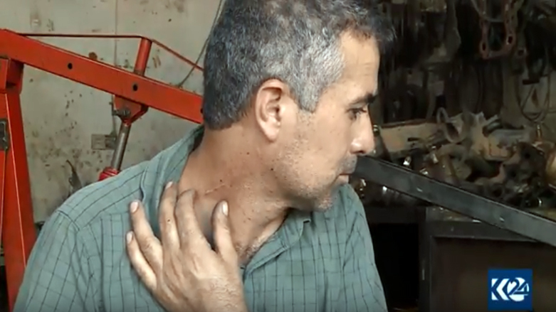 لە دھۆك هه‌ڵه‌ی پزیشكێك ده‌ستی هاووڵاتییه‌ك له‌ كارده‌خات