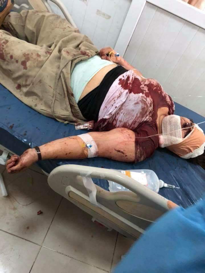 Sekreterê Giştî yê HDK birîndar bû