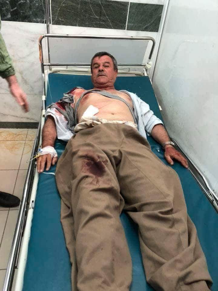 Sekreterê Giştî yê HDK birîndar bû