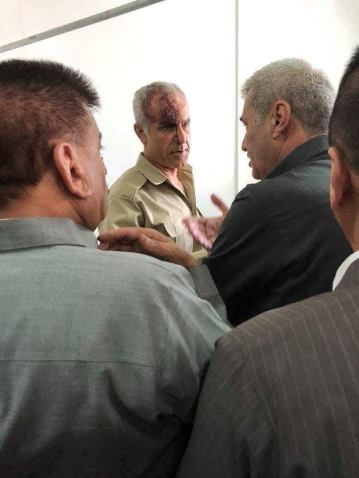 Sekreterê Giştî yê HDK birîndar bû