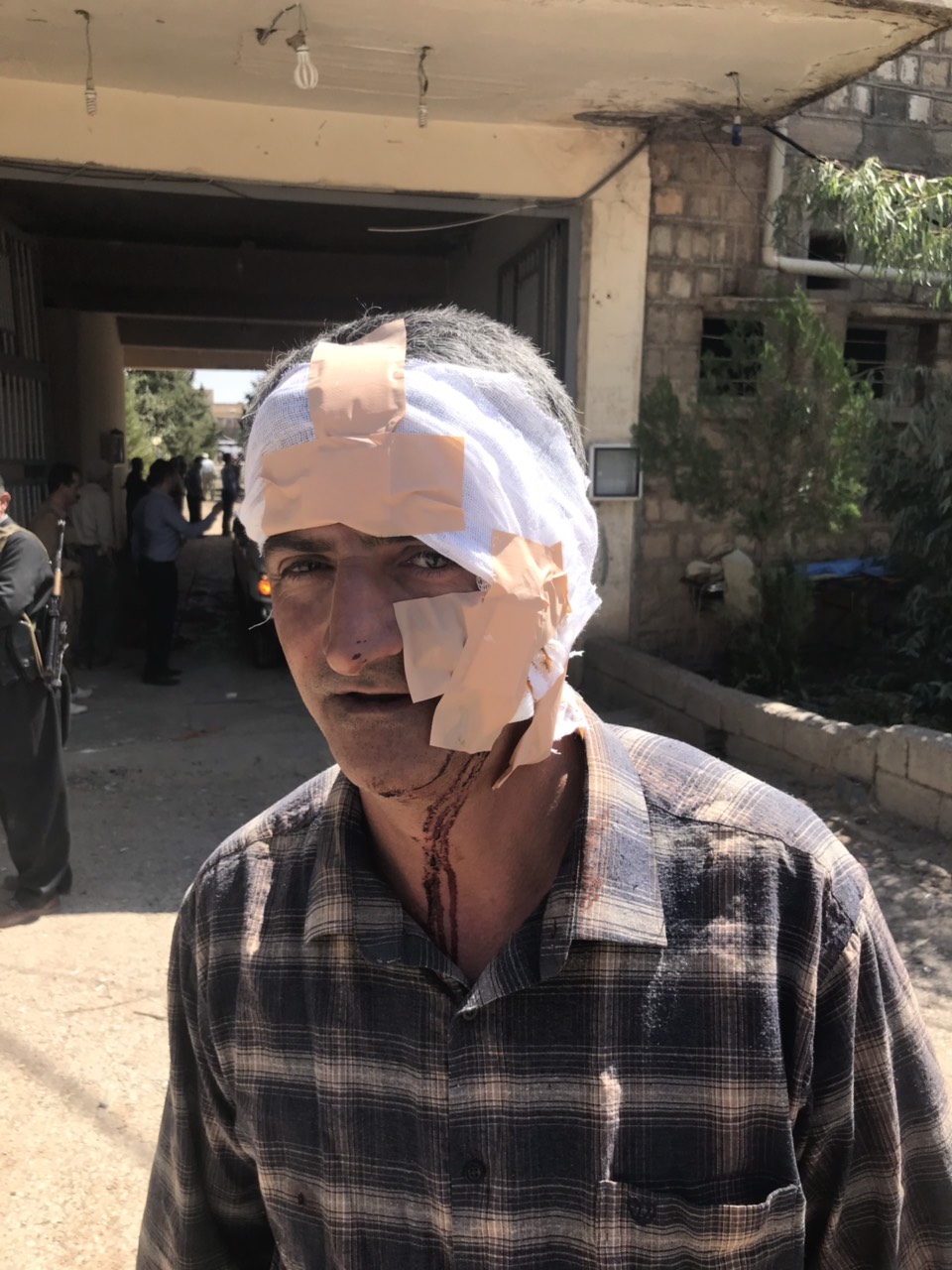 Sekreterê Giştî yê HDK birîndar bû